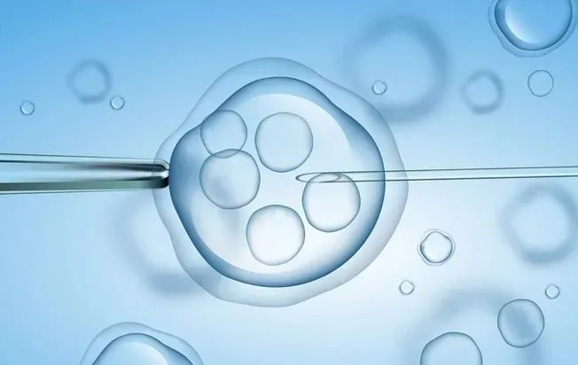 辅助生殖技术  试管婴儿